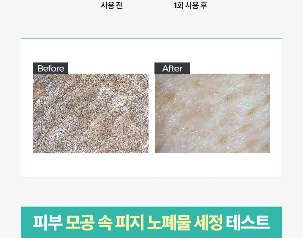 [피지흡착팩] 브링그린 티트리 시카 포어 클레이팩 스트롱 100g 상세페이지 6